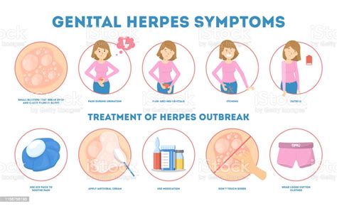 Genital Herpes Symptoms Infectious Dermatology Stock Illustration