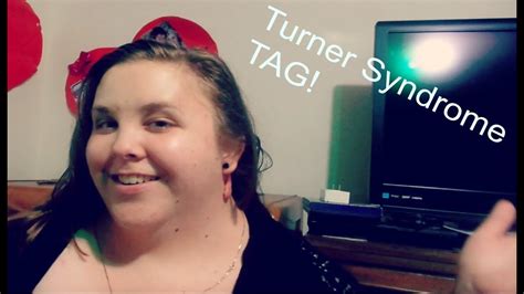 turner syndrome tag youtube