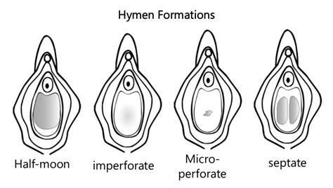 Type Of Vagina Shapes Minetransport