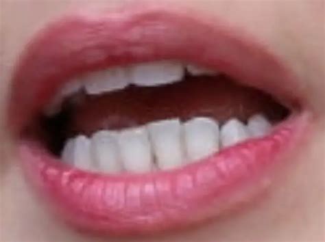 Amber Heard Teeth Pictures