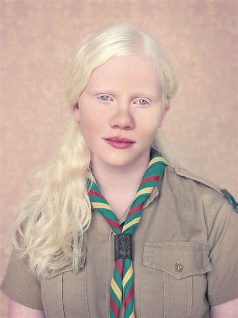 pin  albino people