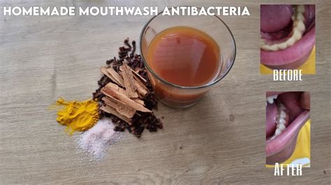how to make homemade mouthwash prevent toothache gum disease and bad