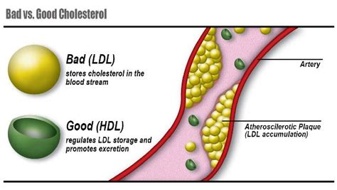 hdl  ldl     difference kauvery hospital