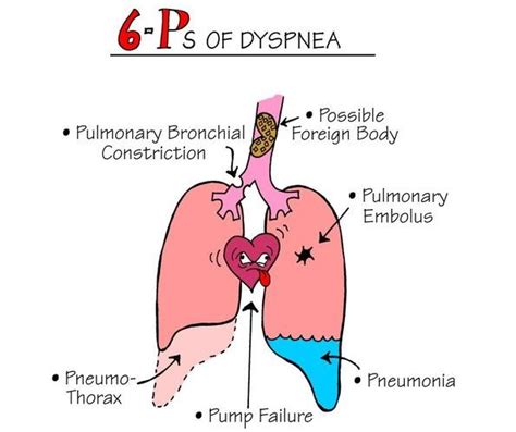 dyspnea current health advice health blog articles  tips