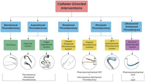 life  full text catheter directed interventions