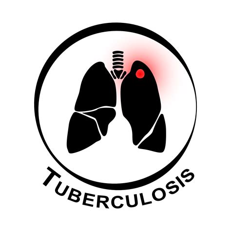 pulmonary tuberculosis symbol lung  cavity  left upper lobe due