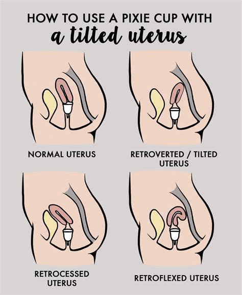 How Do I Use A Menstrual Cup With A Tilted Uterus Pixie Menstrual Cup