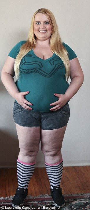 Meet The 23 Year Old Who Feeds Herself 5 000 Calories Per Day Through A