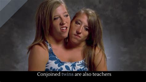 conjoined twins are also teachers alltop viral