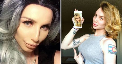 Trans Woman 22 Spends 75 000 On Boob Job Fillers And Botox In Quest