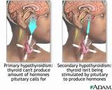 Growth On Pituitary Gland Symptoms