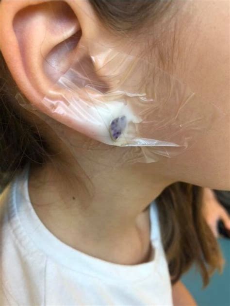 claire s accessories ear piercing left girl 7 in hospital metro news