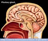 Pituitary Gland Cancer Pictures
