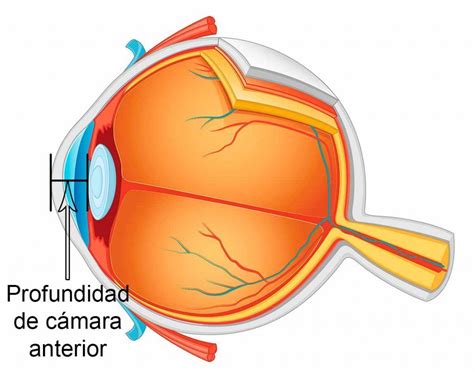 la profundidad de camara anterior  acd area oftalmologica