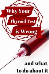 Joint Problems And Hypothyroid Pictures