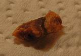 Images of How To Clean Ear Wax
