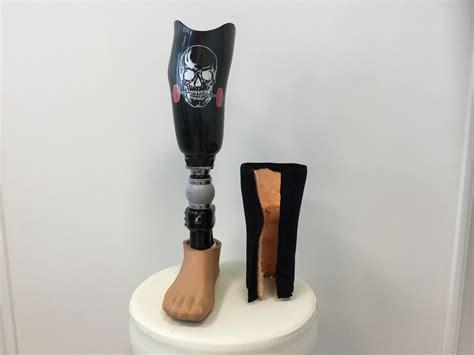 amputation de jambe prothese de jambe en bretagne opr orthese prothese reeducation