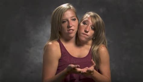 An Update On Abby And Brittany Hensel — The World’s Most Famous