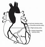 Arteries Sunnybrook Coronary Heart Ca sketch template