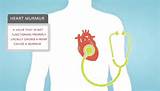 Photos of Heart Murmur Symptoms In Adults