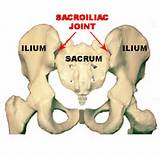 Images of Unilateral Low Back Pain