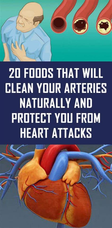 foods   clean  arteries naturally  protect