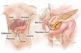 What Are Symptoms Of Pancreas Problems