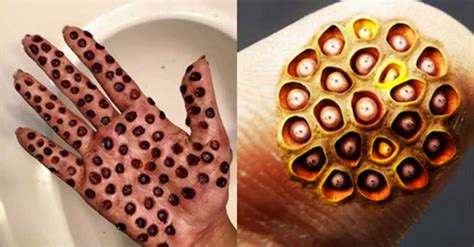 these vomit inducing photos will trigger your trypophobia