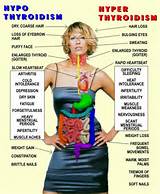 About Thyroid Symptoms Photos