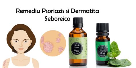 Dermatita Seboreica Vs Psoriazisul Remediu Natural Oleya Cu Uleiuri