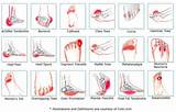 Images of Foot Pain Diagnosis