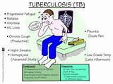 Tb Symptoms Images