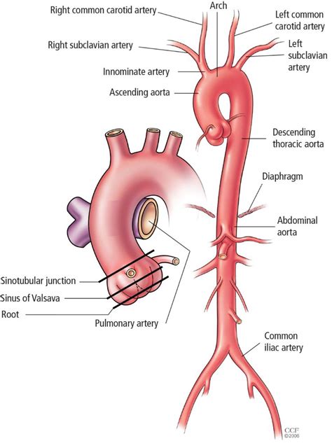 aortic valve  ascending aorta replacement