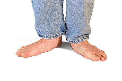 flat feet symptoms treatment upmc healthbeat