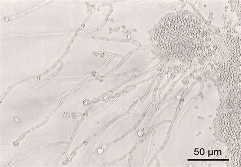 vaginitis candida bv and trichomoniasis stomp on step1