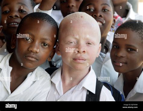 suedafrika junge albino mit schwarzen schuelern  einer schule