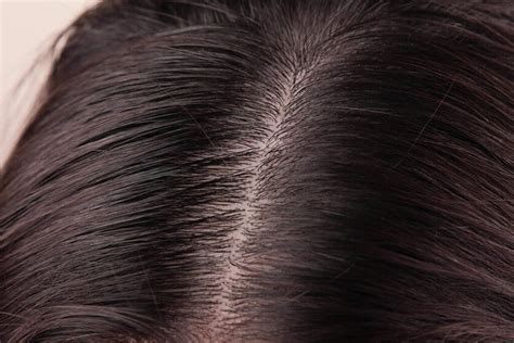 healthy scalp       vegamour blog