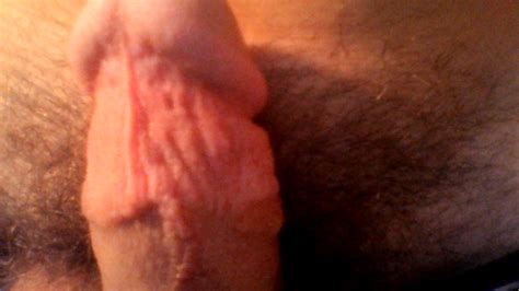 excessive masturbation after epilepsy surgery other video xxx