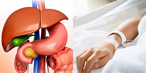 Gallbladder Removal Here’s What To Expect Before During And After Self