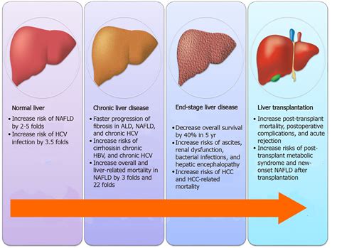 progress  liver disease liver