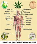 Marijuana Health Benefits Images