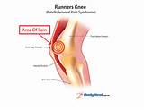 How To Diagnose A Knee Injury Images