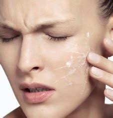 winter care  women sensitive skin moisturizer lifestyle