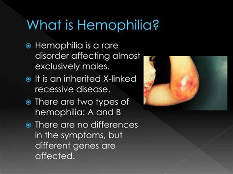 ppt hemophilia powerpoint presentation free download id 2758784