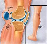 Knee Diagnosis