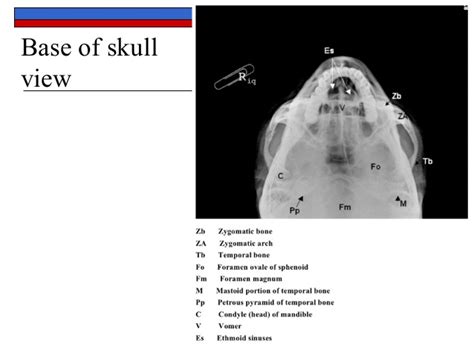 basic anatomy views importance and positioning interpretation skull