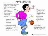 Acute Appendicitis Pain Images