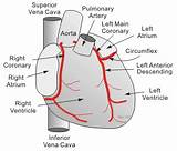 Images of The Coronary Arteries Supply Blood To The
