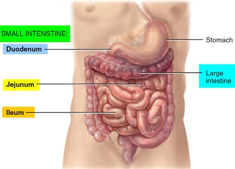 bowel obstruction small large  symptoms treatment