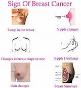 Images of Symptoms In Breast Cancer